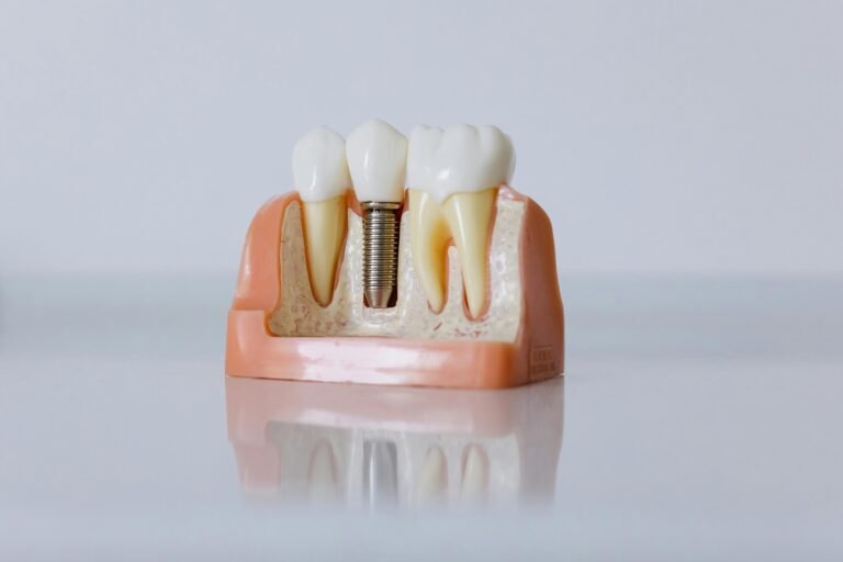 Restoring Confidence with Denture Implants